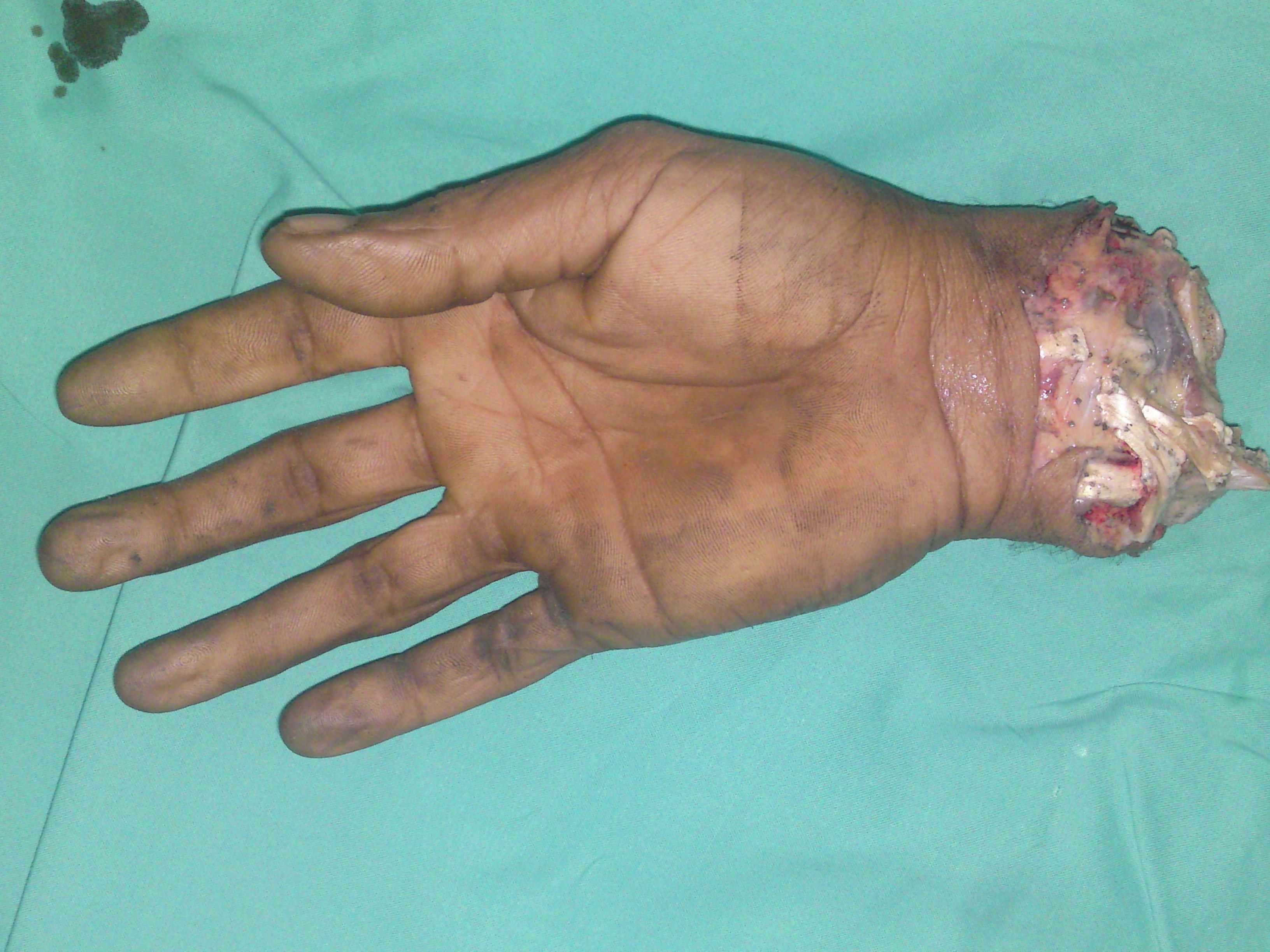 fig 2 f2